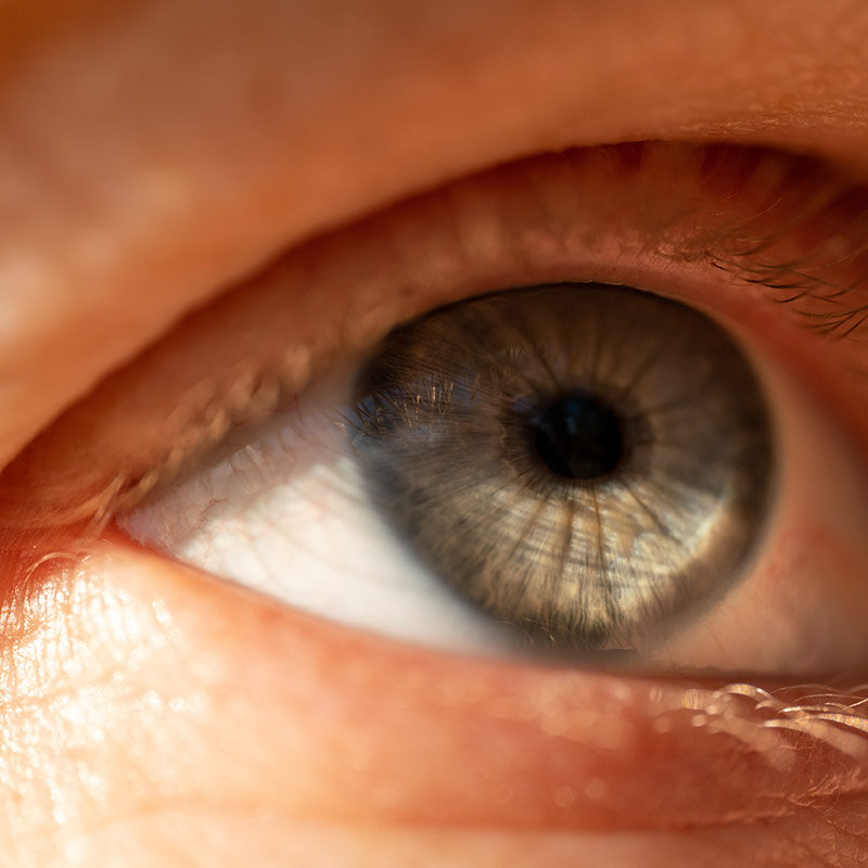 Sunken eyes: possible causes and effective solutions