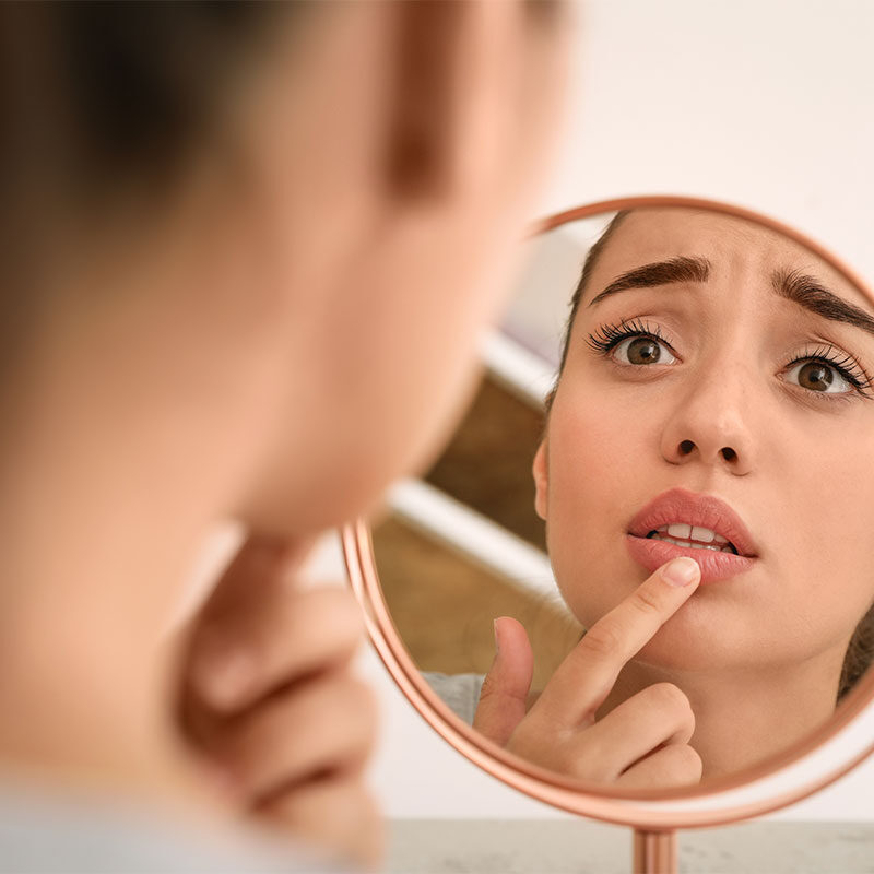 Gonfiore post filler: cause e rimedi Gonfiore post filler: cause e rimedi