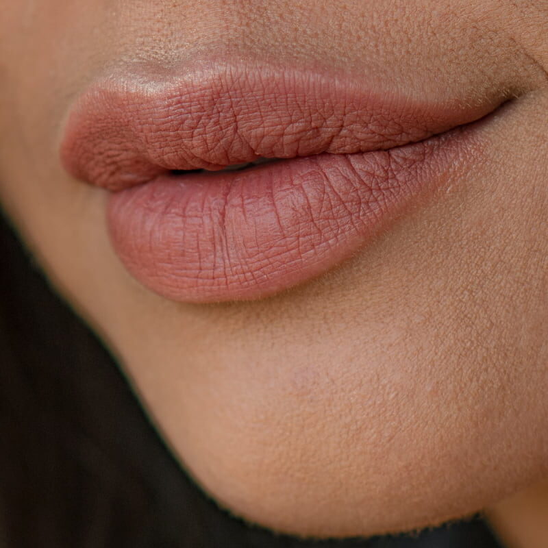 Lip fillers, how long does the effect last?