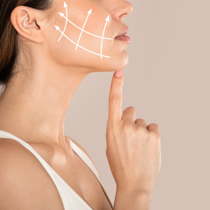 Droopy cheeks, can fillers lift them?