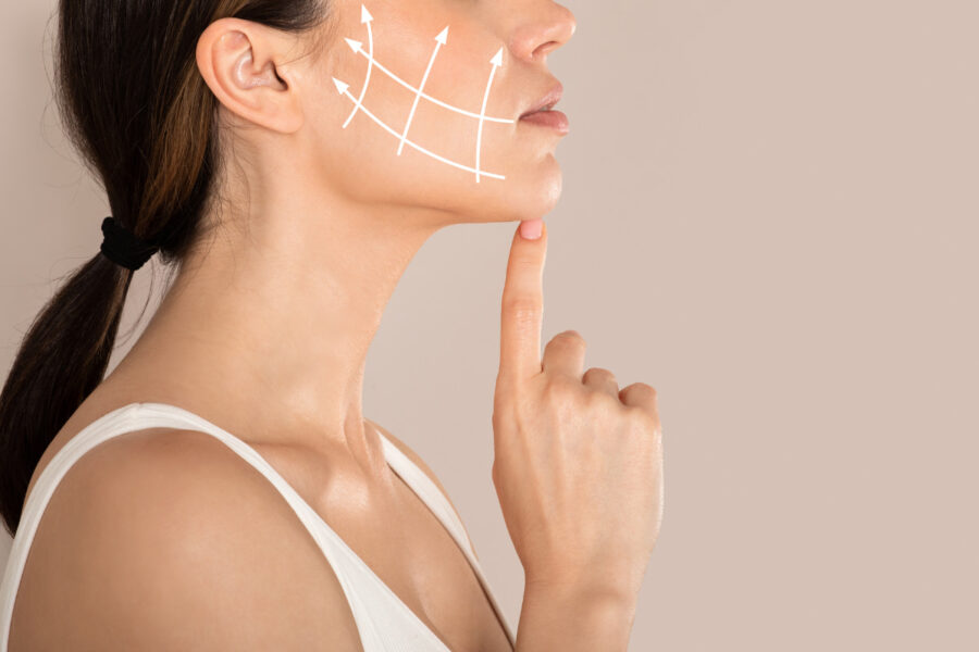 Guance cadenti, il filler può alzarle?