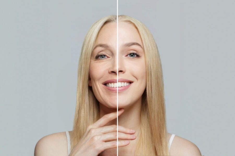 Invecchiamento cutaneo: tutto quello che c'è da sapere