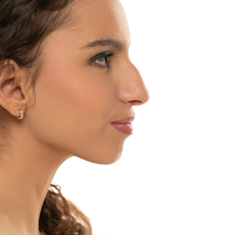 Aquiline nose: characteristics and remedies