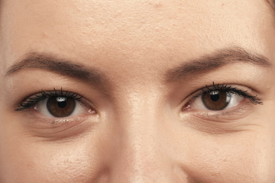 2 rimedi per un contorno occhi grinzoso