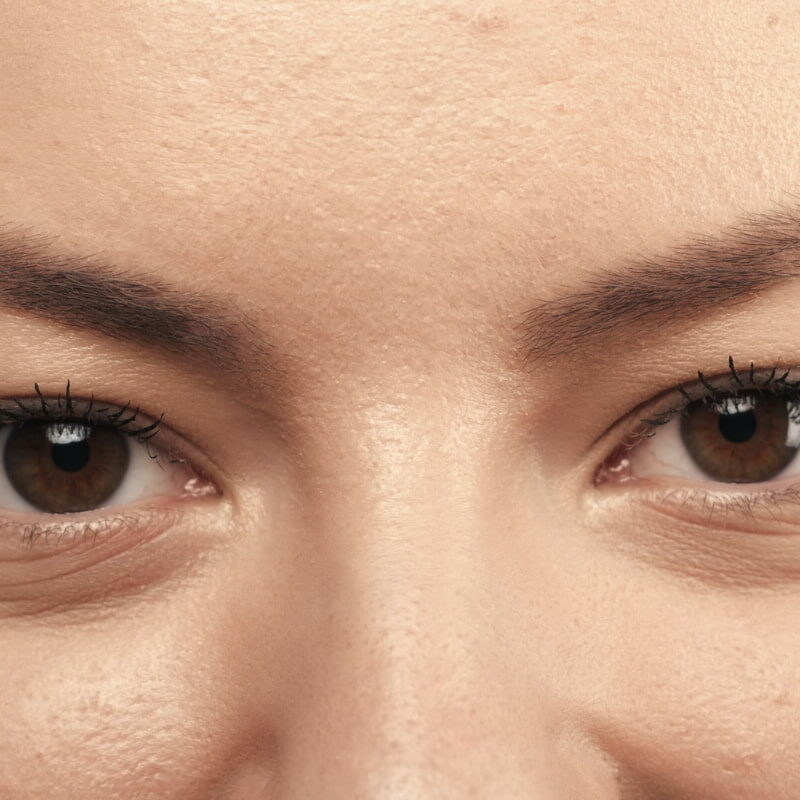 2 remedies to eliminate wrinkly eye contours
