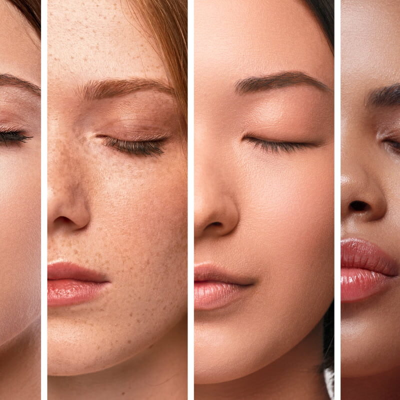 Skin types: the complete guide to recognise them