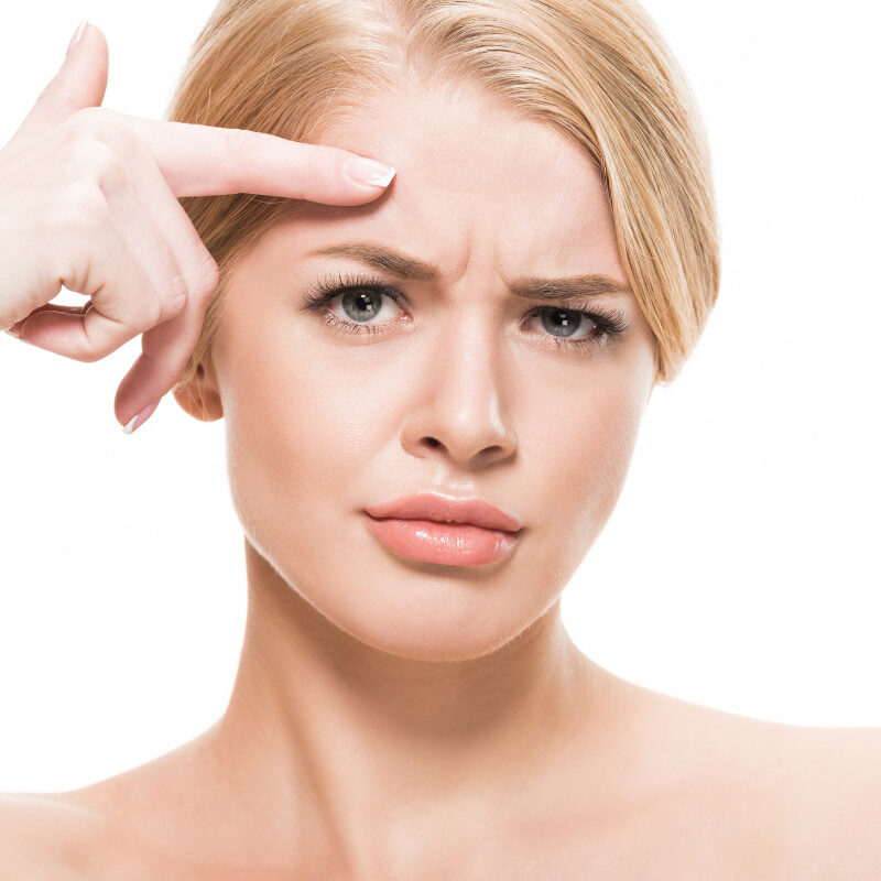 Rughe glabellari, cosa sono e come eliminarle