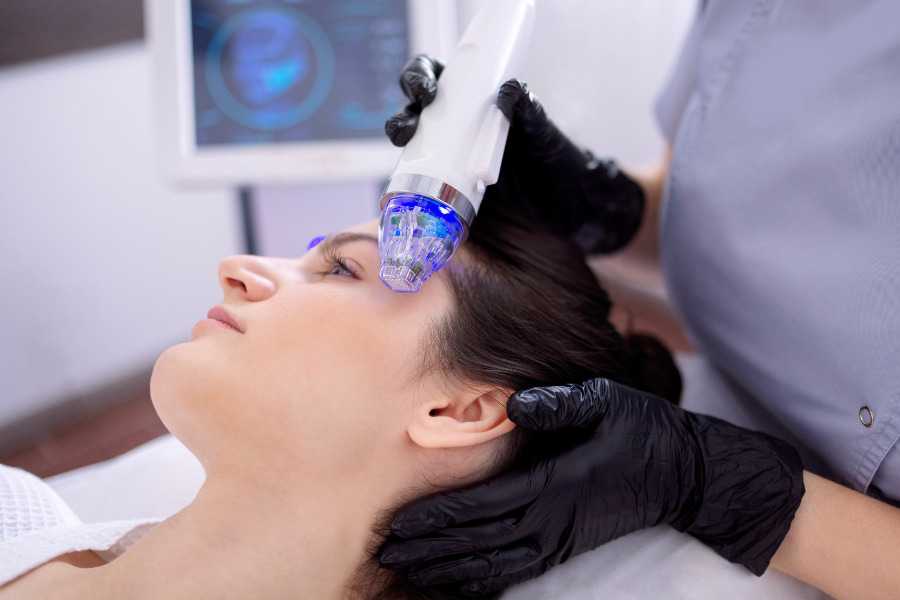 Pro e contro del microneedling al viso